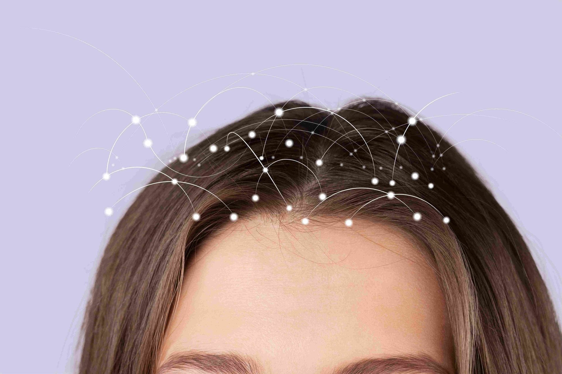 Kerastase Symbiose Dandruff and Causes